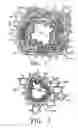 Fig. 02 - METHODS FOR TREATING AIRWAYS
