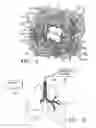 Fig. 03 - METHODS FOR TREATING AIRWAYS