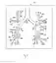 Fig. 06 - METHODS FOR TREATING AIRWAYS
