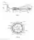Fig. 10 - METHODS FOR TREATING AIRWAYS