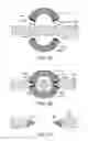 Fig. 04 - Medical instrument and method of use