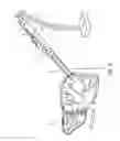Fig. 14 - Multiple treatment zone ablation probe