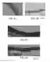 Fig. 20 - MYOCARDIAL ABLATION BY IRREVERSIBLE ELECTROPORATION