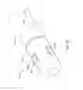 Fig. 25 - Medical devices with a flexible electrode assembly coupled to an ablation tip