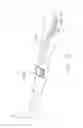 Fig. 06 - Preparation For Endovenous Laser Ablation
