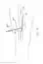 Fig. 09 - Preparation For Endovenous Laser Ablation
