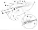 Fig. 01 - Illuminated catheterization device