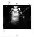 Fig. 10 - System and devices for image targeting