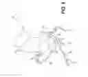 Fig. 07 - Method and system for image processing to determine patient-specific blood flow characteristics