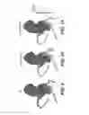 Fig. 08 - Method and system for image processing to determine patient-specific blood flow characteristics