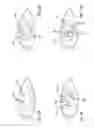 Fig. 06 - Real-time surgical reference indicium apparatus and methods for surgical applications
