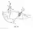 Fig. 06 - Methods and devices for remotely controlling movement of surgical tools