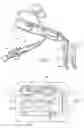 Fig. 03 - Fluid Bypass Device for Handheld Dental Devices