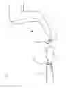 Fig. 05 - Method for producing a patient-specific replacement bracket for an orthodontic treatment, and bracket produced by this method