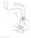 Fig. 06 - Method for producing a patient-specific replacement bracket for an orthodontic treatment, and bracket produced by this method