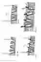 Fig. 13 - Dental implant device, system and method of use