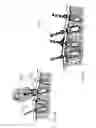 Fig. 14 - Dental implant device, system and method of use