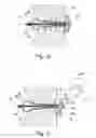 Fig. 05 - Urine flow control device, such as an incontinence device