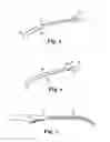 Fig. 03 - IMPLANTS, TOOLS, AND METHODS FOR TREATMENTS OF PELVIC CONDITIONS