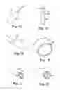 Fig. 06 - IMPLANTS, TOOLS, AND METHODS FOR TREATMENTS OF PELVIC CONDITIONS