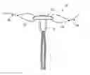 Fig. 01 - Elongate guide element for an implant