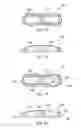 Fig. 05 - Elongate guide element for an implant