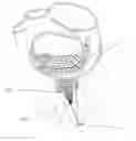 Fig. 01 - Tissue restraining devices and methods of use