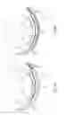 Fig. 17 - Tissue restraining devices and methods of use
