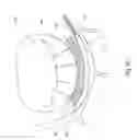 Fig. 28 - Tissue restraining devices and methods of use