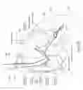 Fig. 30 - Tissue restraining devices and methods of use