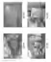 Fig. 42 - Tissue restraining devices and methods of use