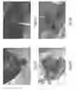 Fig. 44 - Tissue restraining devices and methods of use