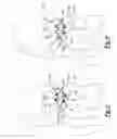 Fig. 05 - Method and apparatus for bone fixation