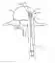 Fig. 01 - SPINAL IMPLANT SYSTEM AND METHOD