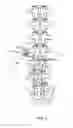 Fig. 03 - SPINAL IMPLANT SYSTEM AND METHOD