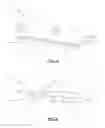 Fig. 10 - Total disc replacement system and related methods