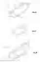 Fig. 24 - Total disc replacement system and related methods