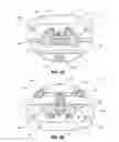 Fig. 03 - Spinal implant configured for midline insertion