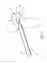 Fig. 10 - Surgical cut validation tool and method