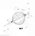 Fig. 16 - VASCULAR REMODELING DEVICE