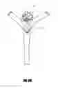 Fig. 22 - VASCULAR REMODELING DEVICE