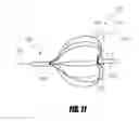 Fig. 23 - VASCULAR REMODELING DEVICE