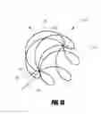 Fig. 25 - VASCULAR REMODELING DEVICE