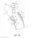 Fig. 05 - Elongate medical device