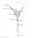 Fig. 01 - Stent removal snare and dilator