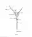 Fig. 06 - Stent removal snare and dilator