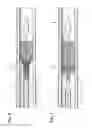Fig. 05 - Stent delivery system