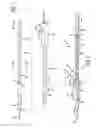 Fig. 02 - Stent graft delivery system with access conduit