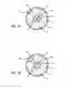 Fig. 03 - Stent graft delivery system with access conduit