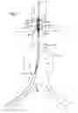 Fig. 08 - Stent graft delivery system with access conduit